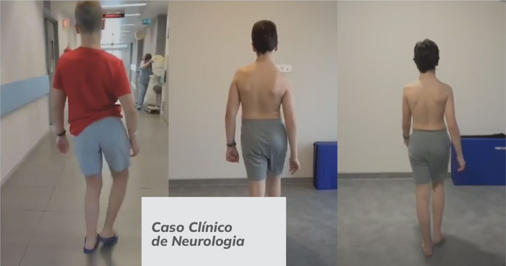 Caso Clínico Neurodor